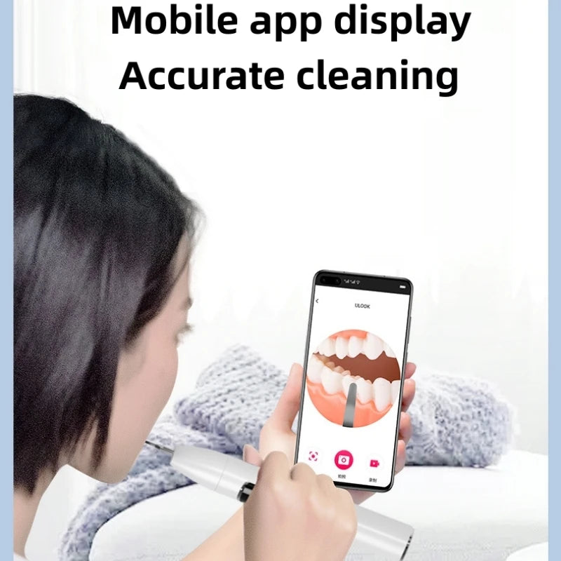WoWihte Incredible Dental Calculus Remover Teeth 2025 Careful Edition